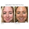 Alpha Beta Glow Pad For Face Intense Glow - Image 5