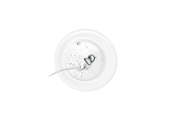 Gel - Image 2