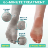 PoshPeel Pedi Cure – 1 Pair - Image 4