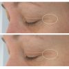 StriVectin Hyaluronic Tripeptide Gel-Cream for Eyes - 2-pack - Image 5